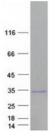 SDS-PAGE (LIN28A-1045HFL).jpg